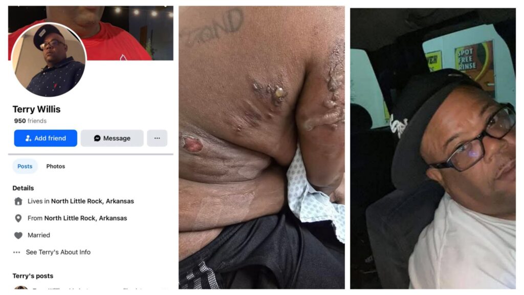 Photo: Husband, Terry Willis, Poured Hot Grease On His Wife Body In Arkansas 10 incollage 20250209 2226127072651428774100697056 1024x576 2