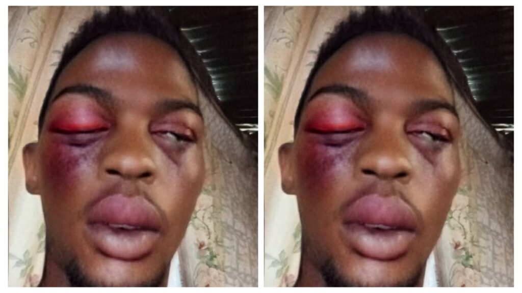 Photo: Man, Thabani Khumalo, Gets Beaten Up With A Stick By His Girlfriend Over R80 In Ezakheni 1 incollage 20250211 0122577101186802168062203557 1024x576 2
