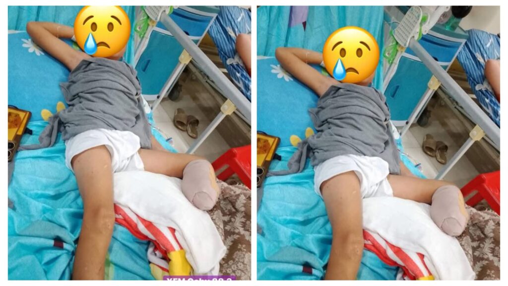 Photo: Outrage As Ryle Sam Quimada Leg Is Amputated Because The Nurse Stitched It To His Leg After Being Injured By Glass And Not A Doctor In Barangay Campo 4 incollage 20250213 1103173301645631945136644602 1024x576 2