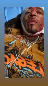 Video: Rapper, Bedo Richasz, Got Shot In The Head Aft Being Setup By A Woman 1 17451519932279152688335312993995 169x300 2