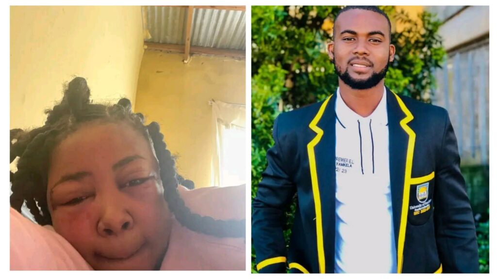 Photo: Gbv Activist, Yamkela Situnda, Goes Viral For Beating Up A Woman, Chizzled Samente 1 incollage 20250427 1132260781017378541190741459 1024x576 2