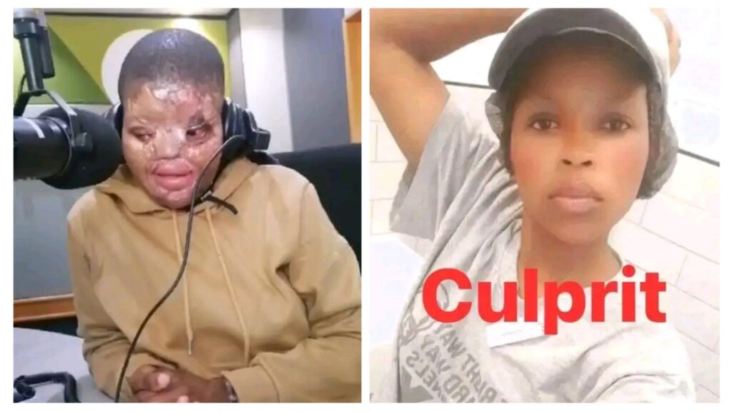 Video: Protests After Kfc Employee, Mamanatasha Bokang, Poured Acid On A Woman, Mmapeu Imbewu Mamabokang Hlanga, Because Of A Man In Zebediela 1 incollage 20250706 1406432664197449746064596096 1024x576 2