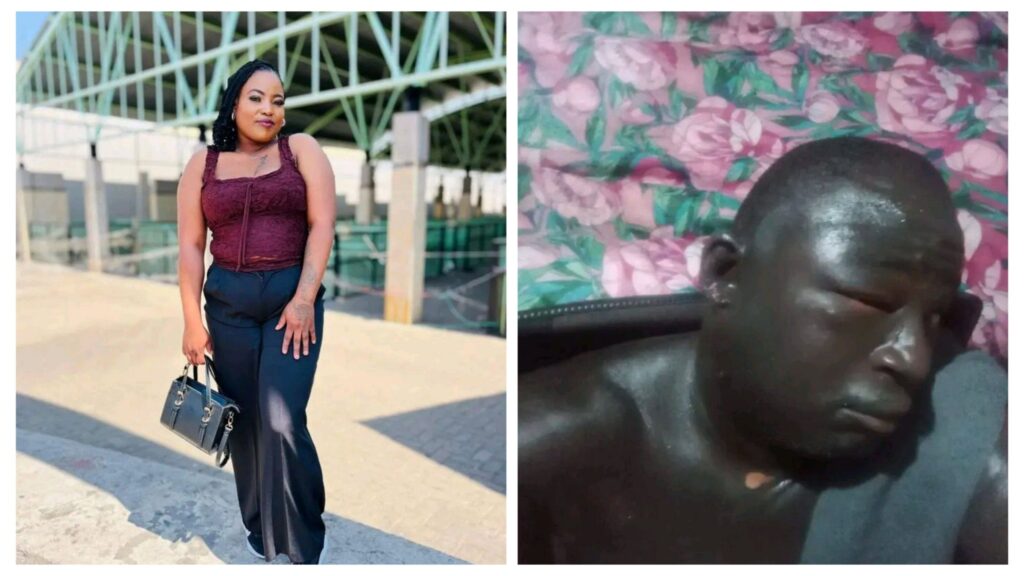 Photo: Dorah Moneko Molokomme Poured Hot Cooking Oil On Mushe Manamela 1 incollage 20251207 1340073754079179106453389476